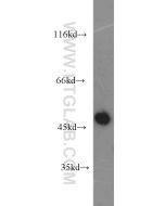 CXCR2 Polyclonal antibody proteintech 20634-1-AP