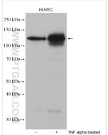 E-selectin/CD62E Polyclonal antibody proteintech 20894-1-AP