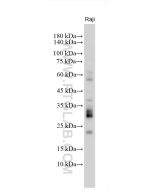 TNFSF11/RANKL Polyclonal antibody proteintech 23408-1-AP