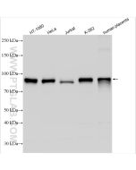 CD71 Polyclonal antibody proteintech 10084-2-AP