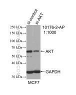 AKT Polyclonal antibody proteintech 10176-2-AP