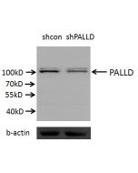 Palladin Polyclonal antibody proteintech 10853-1-AP