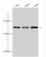 DNMT1 Polyclonal antibody proteintech 24206-1-AP