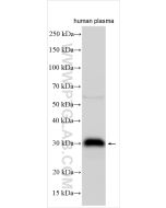 Adiponectin Polyclonal antibody proteintech 21613-1-AP