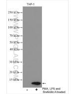 CXCL8/IL-8 Polyclonal antibody proteintech 17038-1-AP