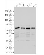 SHB Polyclonal antibody proteintech 31967-1-AP