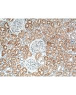 TIMP2 Polyclonal antibody proteintech 17353-1-AP