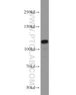 PPP1R15B Polyclonal antibody proteintech 14634-1-AP