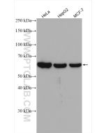 P4HA2 Polyclonal antibody proteintech 13759-1-AP