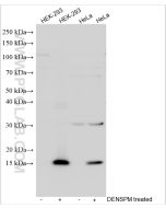 SAT1 Polyclonal antibody proteintech 10708-1-AP