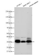 FCGR4/CD16-2 Polyclonal antibody proteintech 33531-1-AP