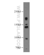 INSR/CD220 Polyclonal antibody proteintech 20433-1-AP