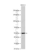 CYP1B1 Polyclonal antibody proteintech 18505-1-AP