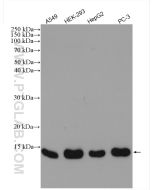 FDX1 Polyclonal antibody proteintech 12592-1-AP