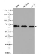 PARP2 Polyclonal antibody proteintech 55149-1-AP