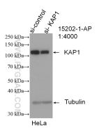 KAP1 Polyclonal antibody proteintech 15202-1-AP