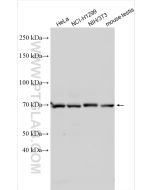METTL16 Polyclonal antibody proteintech 19924-1-AP