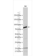 RANK/TNFRSF11A Polyclonal antibody proteintech 55293-1-AP