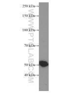 Tubulin Beta Class V Monoclonal antibody proteintech 66362-1-Ig