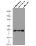 RNF126 Monoclonal antibody proteintech 66647-1-Ig