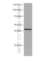 FADS2 Monoclonal antibody proteintech 68026-1-Ig