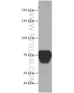 Hemopexin Monoclonal antibody proteintech 66479-1-Ig