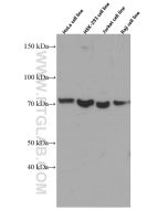 CDC6 Monoclonal antibody proteintech 66021-1-Ig