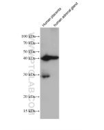 HSD3B2 Monoclonal antibody proteintech 67572-1-Ig