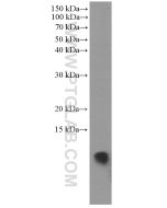 S100A11 Monoclonal antibody proteintech 60024-1-Ig