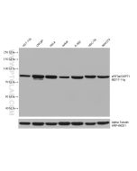 eRF3a/GSPT1 Monoclonal antibody proteintech 68217-1-Ig