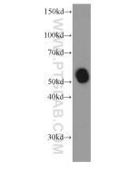 Pancreatic alpha-amylase Monoclonal antibody proteintech 66133-1-Ig