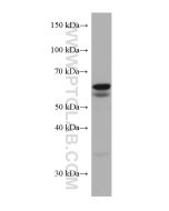 SQLE Monoclonal antibody proteintech 67206-1-Ig