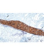 Aggrecan Monoclonal antibody proteintech 68350-1-Ig