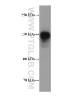 Collagen Type I Monoclonal antibody proteintech 66761-1-Ig