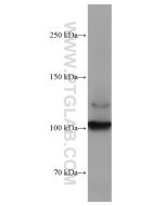 DDR2 Monoclonal antibody proteintech 67126-1-Ig