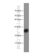 C1qC Monoclonal antibody proteintech 66268-1-Ig