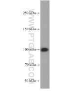 MMS19 Monoclonal antibody proteintech 66049-1-Ig