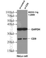 CD9 Monoclonal antibody proteintech 60232-1-Ig