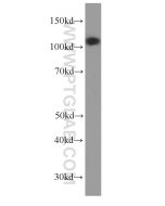 p120 Catenin Monoclonal antibody proteintech 66208-1-Ig