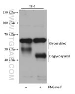 ST6GAL1 Monoclonal antibody proteintech 68633-1-Ig