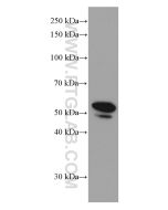 Cytokeratin 13 Monoclonal antibody proteintech 66684-1-Ig