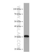 IGFBP6 Monoclonal antibody proteintech 67567-1-Ig