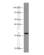 SIRT5 Monoclonal antibody proteintech 67257-1-Ig