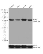 ACAT2 Monoclonal antibody proteintech 68005-1-Ig