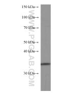 FGL1 Monoclonal antibody proteintech 67391-1-Ig