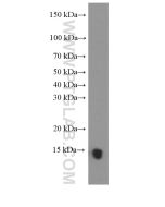 PFN2 Monoclonal antibody proteintech 60094-2-Ig
