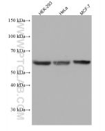 FYN Monoclonal antibody proteintech 66606-1-Ig