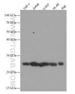 ARHGDIB Monoclonal antibody proteintech 66054-1-Ig