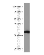 AKR1B1 Monoclonal antibody proteintech 67498-1-Ig
