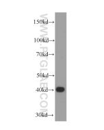 SMN-Exon7 Monoclonal antibody proteintech 60255-1-Ig
